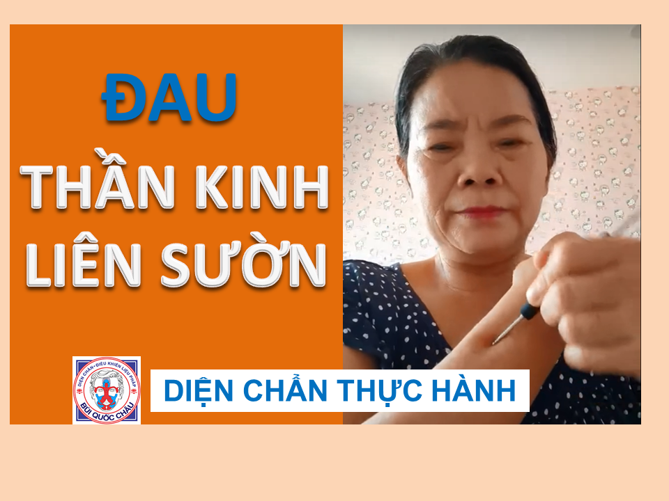 ĐAU THẦN KINH LIÊN SƯỜN