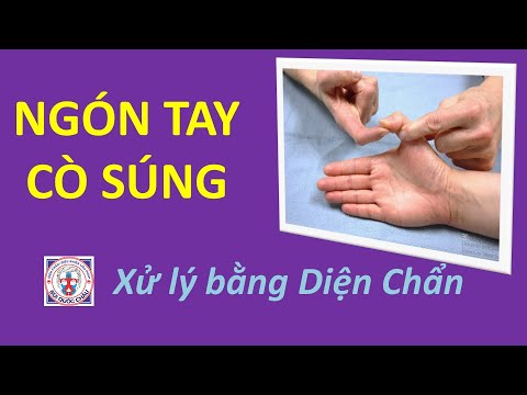 NGÓN TAY CÒ SÚNG, cách chữa cực kỳ đơn giản - Thực Hành Diện Chẩn