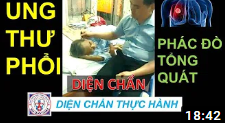 UNG THƯ PHỔI - phác đồ tổng quát Diện Chẩn