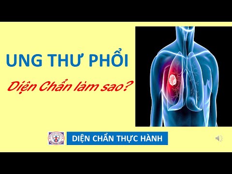 UNG THƯ PHỔI - Thực Hành Diện Chẩn