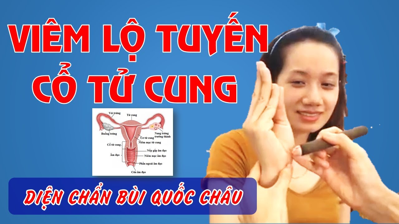 Viêm Lộ Tuyến Cổ Tử Cung - Diện Chẩn làm sao?