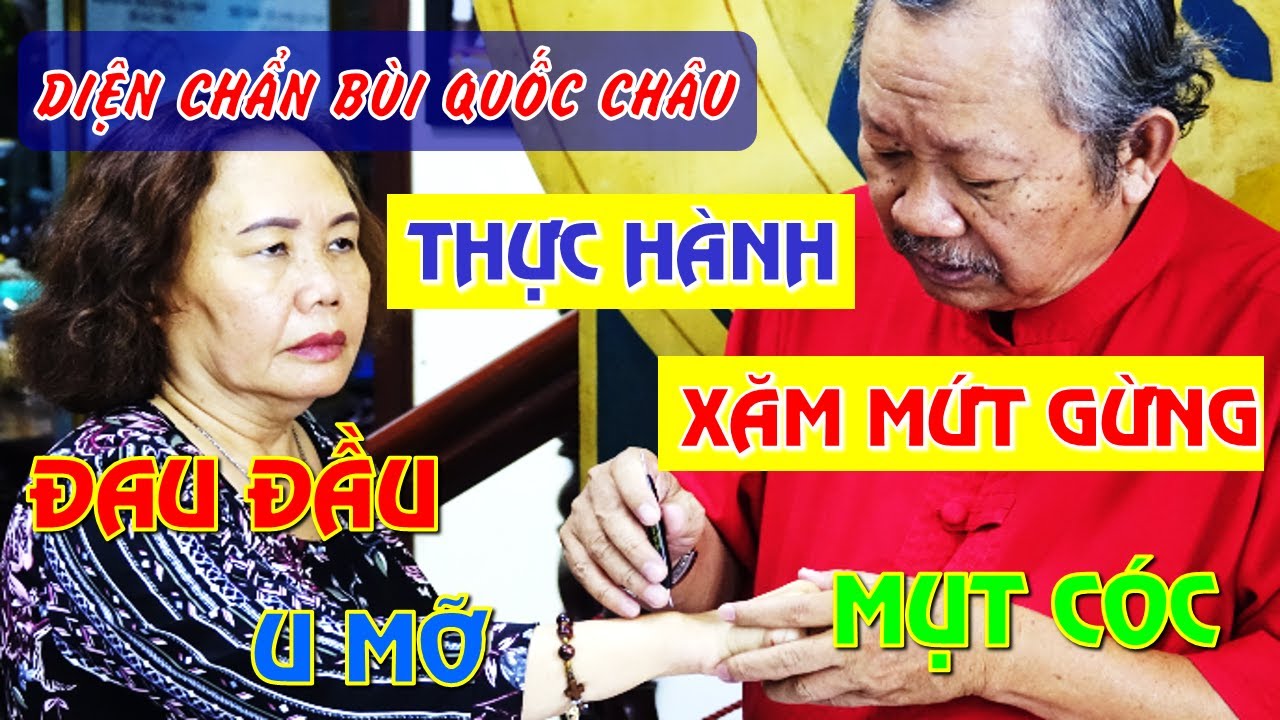 Xăm Mứt Gừng - Đau đầu - U Mỡ - Mụt Cóc || Diện Chẩn